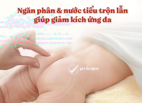 Tã quần Huggies Skin Perfect size M 70 miếng