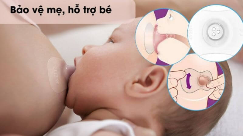 Tìm hiểu về dòng sản phẩm núm trợ ty
