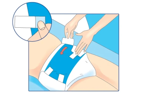  Bỉm cần được thay sau nhiều nhất 4 tiếng sử dụng