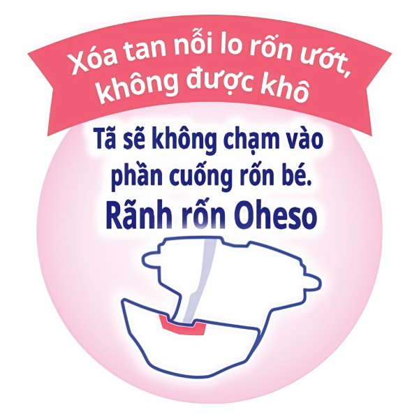 Thiết kế rãnh Oheso bảo vệ cuống rốn của bé